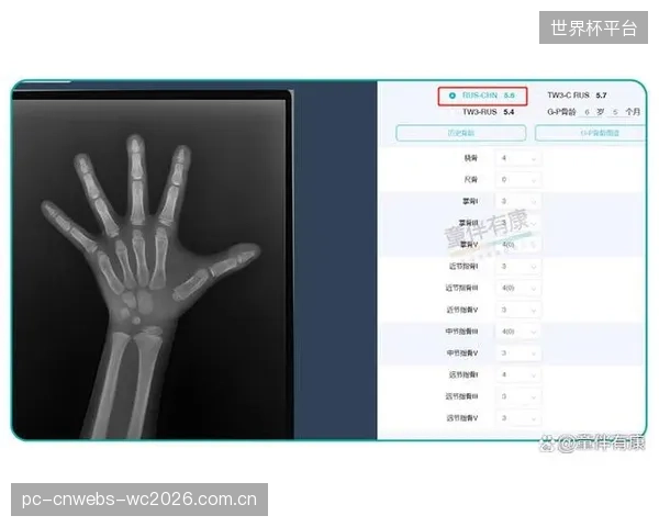 崇明根宝基地引入TW3标准骨龄评估系统，旨在根除选材过程中的年龄造假顽疾
